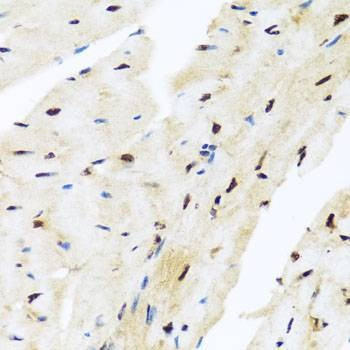 Anti-ZBTB17 Antibody