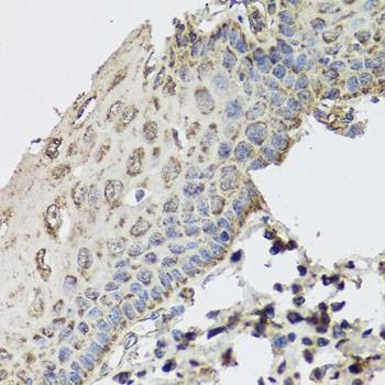 Anti-GBF1 Antibody