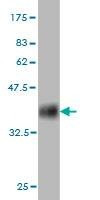 Anti-COX6B1 Antibody