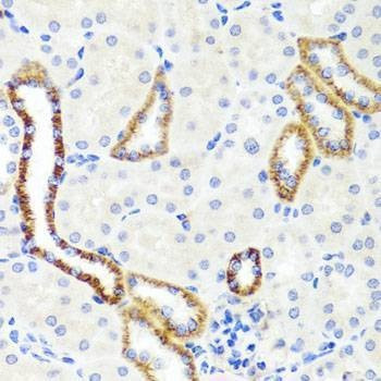 Anti-SYNPO Antibody