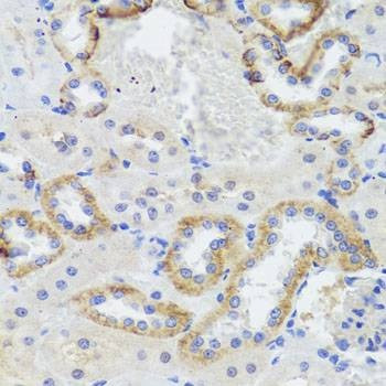 Anti-SYNPO Antibody
