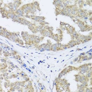 Anti-TIMM10B Antibody