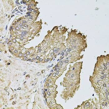 Anti-PTCD3 Antibody