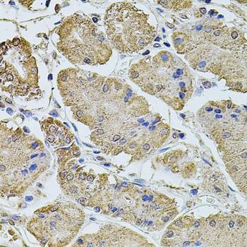 Anti-PTCD3 Antibody