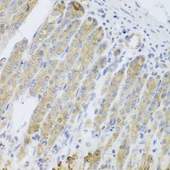 Anti-RARS2 Antibody