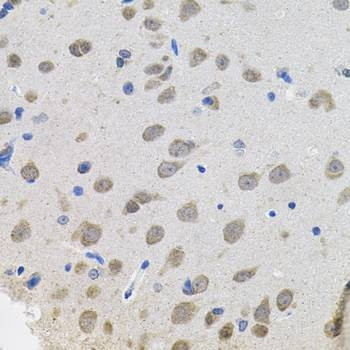 Anti-VEPH1 Antibody