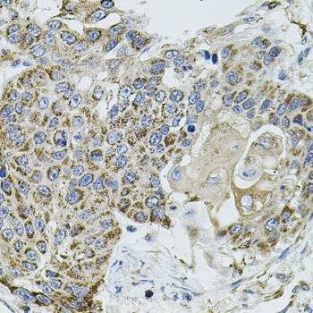 Anti-VEPH1 Antibody