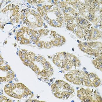 Anti-VEPH1 Antibody
