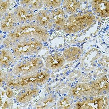 Anti-TEFM Antibody