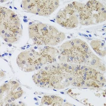 Anti-MTERFD3 Antibody