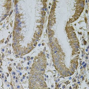 Anti-MTIF3 Antibody