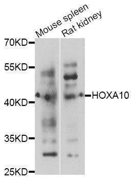 Anti-HOXA10 Antibody
