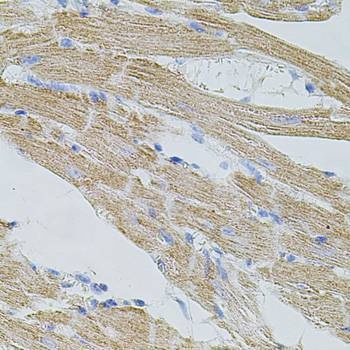 Anti-TRPA1 Antibody
