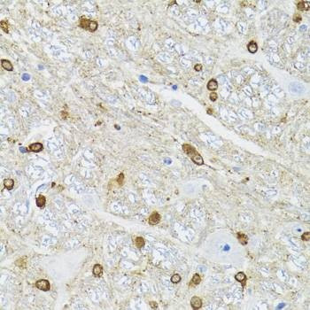 Anti-TPPP Antibody