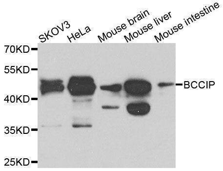 Anti-BCCIP Antibody