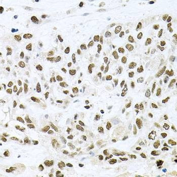 Anti-BCCIP Antibody