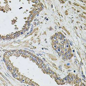 Anti-KCNK9 Antibody