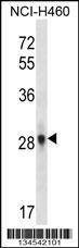Anti-FGF10 (C-term) Antibody