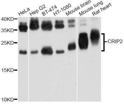 Anti-CRIP2 Antibody