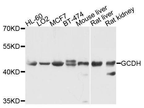 Anti-GCDH Antibody