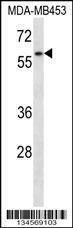 Anti-FANCG (C-term) Antibody