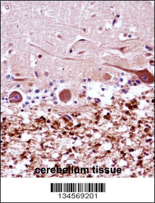 Anti-FANCG (C-term) Antibody