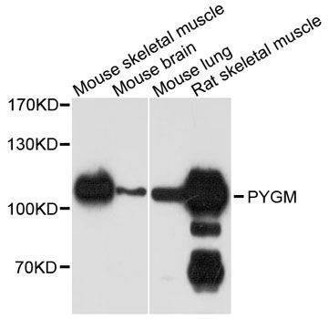 Anti-PYGM Antibody