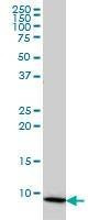 Anti-COX6B1 Antibody