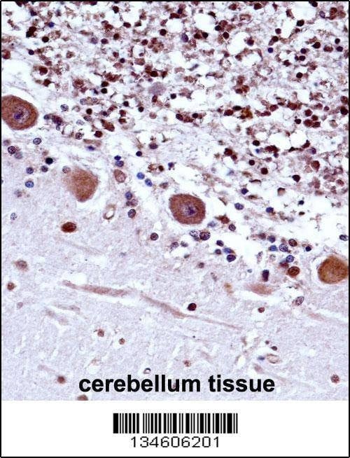Anti-TRA2B (Center) Antibody