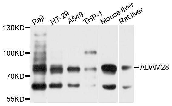 Anti-ADAM28 Antibody