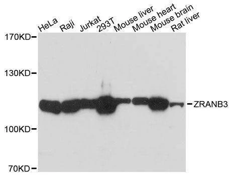 Anti-ZRANB3 Antibody