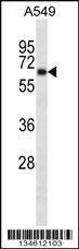 Anti-KCNA3 (Center) Antibody