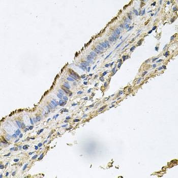 Anti-DSG1 Antibody
