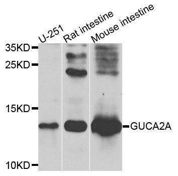 Anti-GUCA2A Antibody