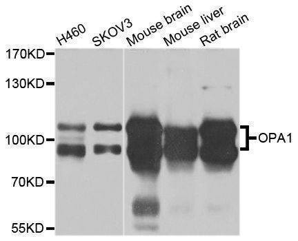 Anti-OPA1 Antibody