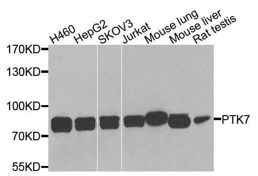 Anti-PTK7 Antibody