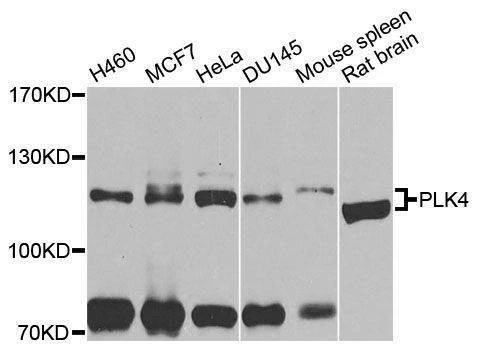 Anti-PLK4 Antibody