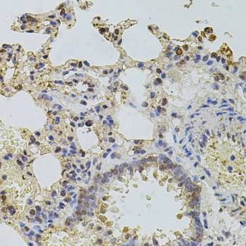 Anti-PLK4 Antibody