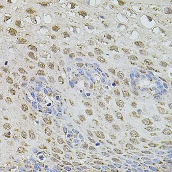 Anti-PLK4 Antibody