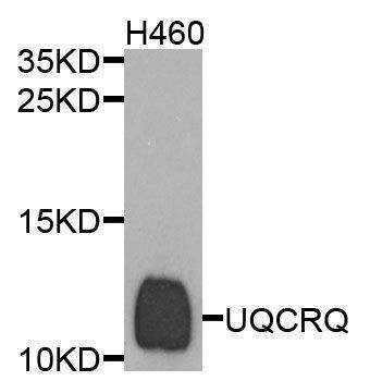Anti-UQCRQ Antibody