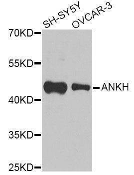 Anti-ANKH Antibody