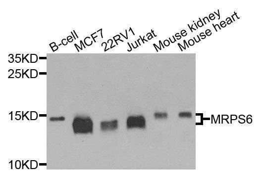 Anti-MRPS6 Antibody