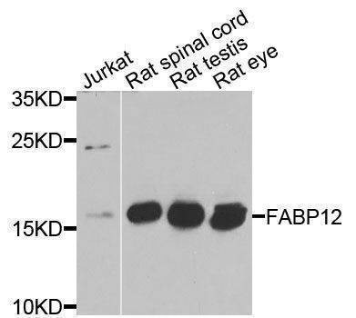 Anti-FABP12 Antibody