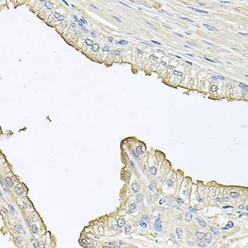 Anti-FABP12 Antibody