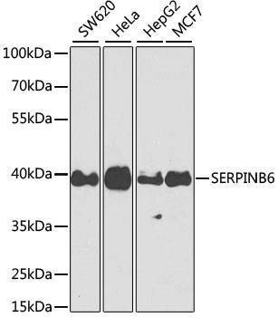 Anti-SERPINB6 Antibody