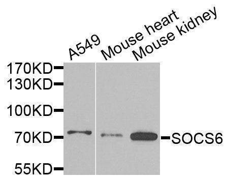 Anti-SOCS6 Antibody