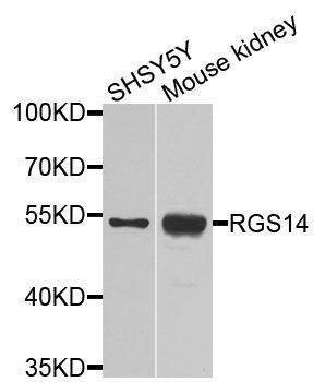 Anti-RGS14 Antibody