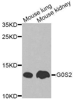 Anti-Mouse G0S2 Antibody