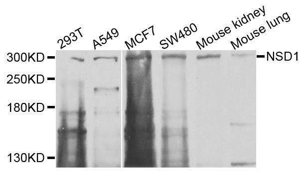 Anti-NSD1 Antibody