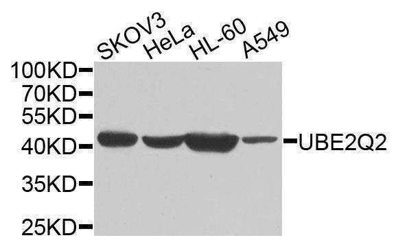 Anti-UBE2Q2 Antibody